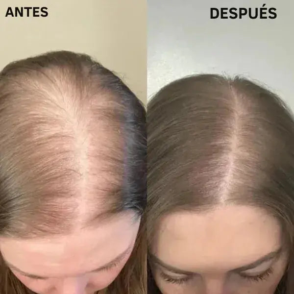 Suplemento masticable acelerador del crecimiento del cabello, sabor frutos rojos | Clínicamente comprobado